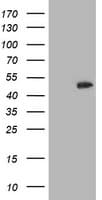 CCM2 / Malcavernin Antibody (clone OTI2E4, Carrier-free)