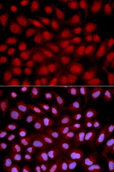 NFATC1 / NFAT2 Antibody