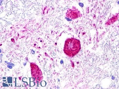 PathPlus™ Polyclonal Rabbit anti-Human MAS1L / MRG Antibody (C-Terminus, IHC)