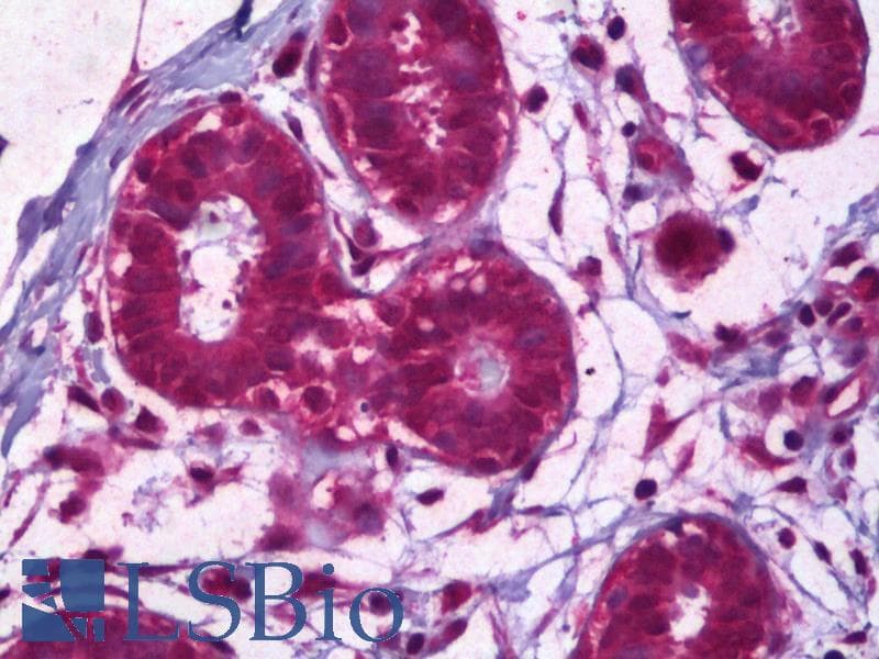 IHC-plus™ Monoclonal Mouse anti-Human IL8 / Interleukin 8 Antibody (clone 5D8, IHC, WB)