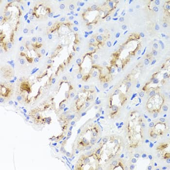 Polyclonal Rabbit anti-Human Adiponectin Antibody (IHC, WB)