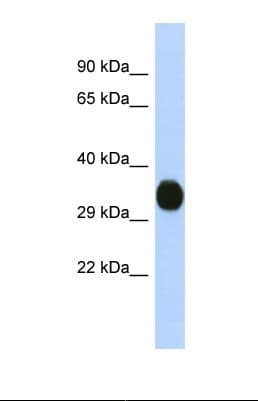 KCNAB2 / Kv-Beta-2 Antibody (aa51-100)