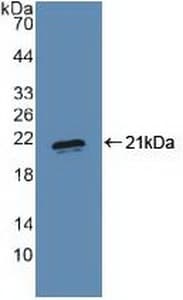 BLIMP1 / PRDM1 Antibody (aa83-203)