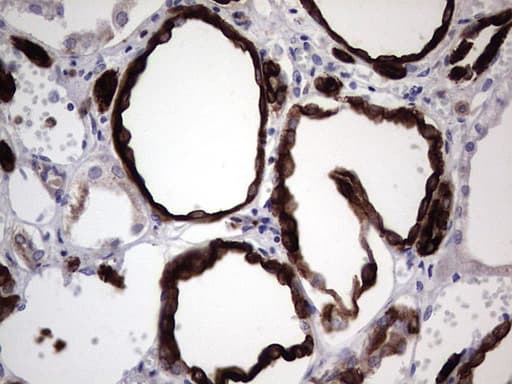 KRT19 / CK19 / Cytokeratin 19 Antibody (aa240-390, clone OTI1C11)