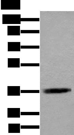 ACAT2 Antibody