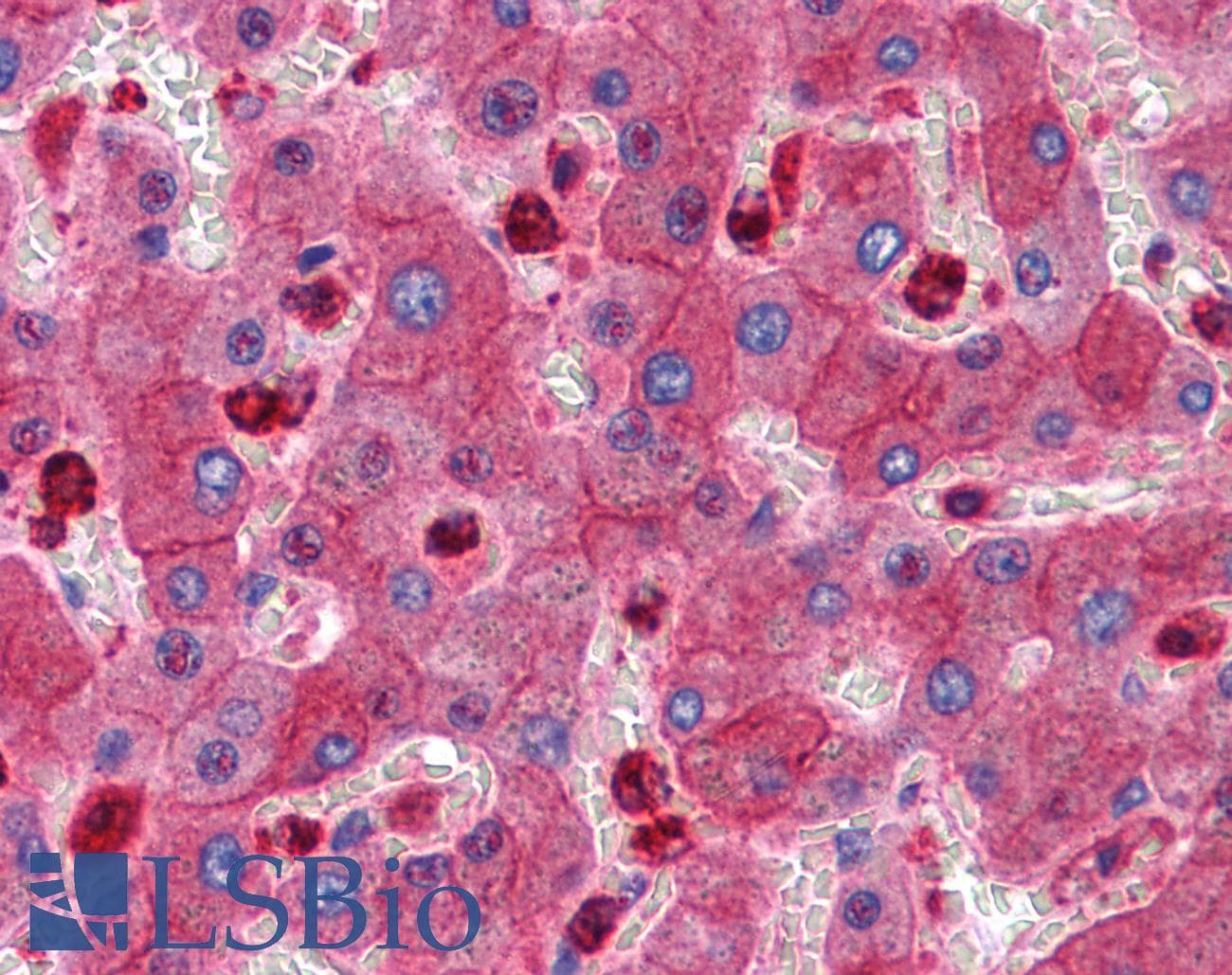 IHC-plus™ RTN3 / Reticulon 3 Antibody (clone 10A8)