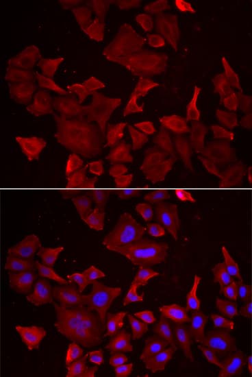 Polyclonal Rabbit anti-Human CASP14 / Caspase 14 Antibody (IHC, IF, WB)