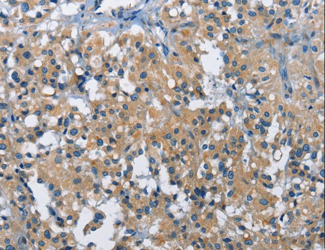 ALK-6 / BMPR1B Antibody