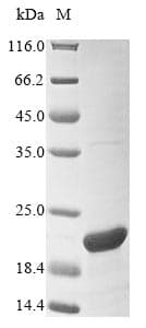 Mouse Urah Protein (Recombinant 10His, N-terminus + Myc, C-terminus)