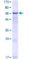 Human SERTAD4 Protein (Recombinant GST)