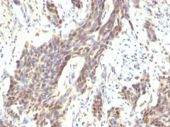 CCND1 / Cyclin D1 Antibody (clone CCND1/809)