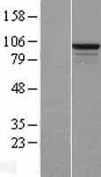 RSBN1L Protein (Over-Expression Lysate Myc-DDK (Flag))