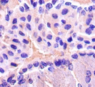 ENO2 / NSE Antibody