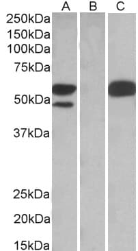 IHC-plus™ Polyclonal Goat anti-Human TRIM21 / RO52 Antibody (aa463-475, IHC, IF, WB)