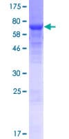 Human FAM160B2 / RAI16 Protein (Recombinant GST)