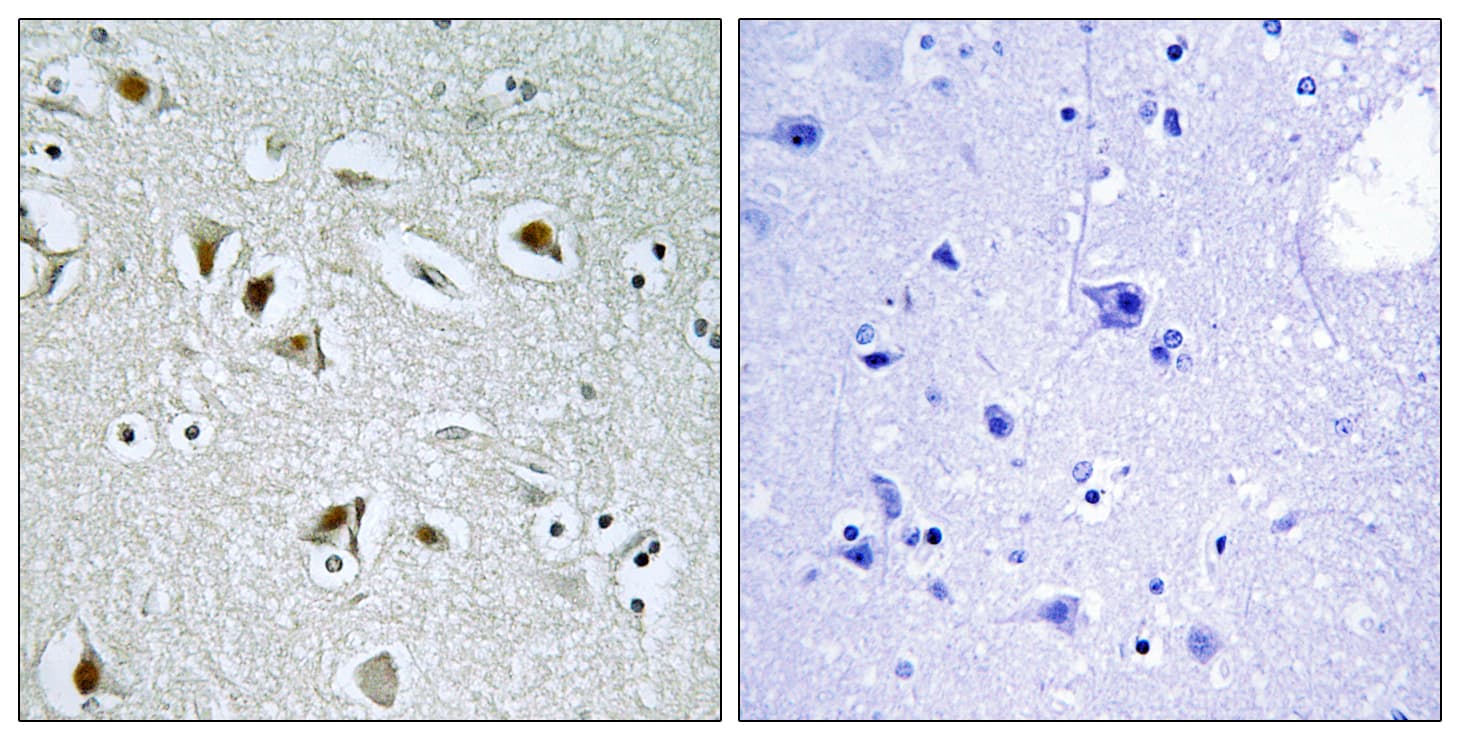 CDK2AP2 Antibody (aa51-100)