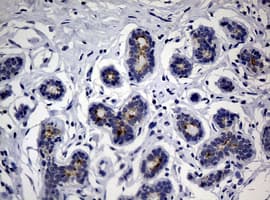 Sialylated Lewis a / CA 19-9 Antibody (clone NS19)