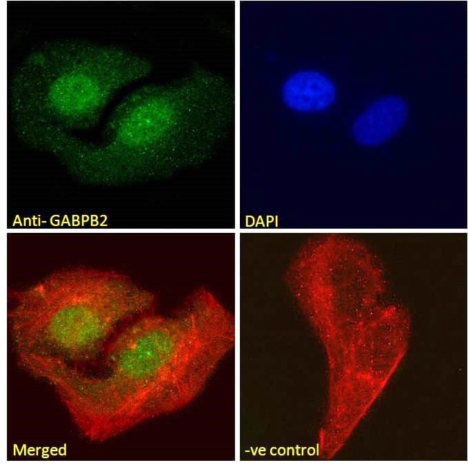 IHC-plus™ Polyclonal Goat anti-Human GABPB1 Antibody (aa198-210, IHC, IF, WB)