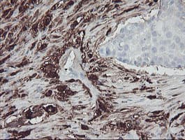 F13A1 / Factor XIIIa Antibody (clone OTI3F1)