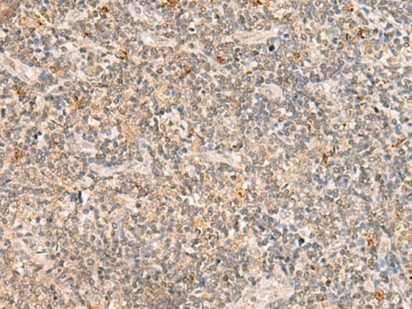 Polyclonal Rabbit anti-Human TBCK / TBCKL Antibody (IHC)