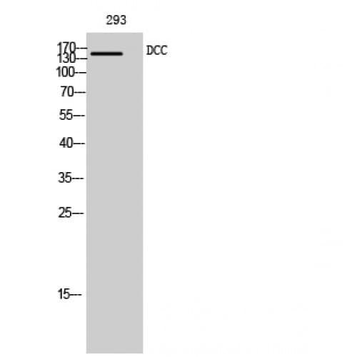 DCC Antibody (410-490 aa, Internal)