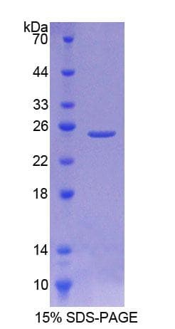 Rat NEU2 / Sialidase 2 Protein (Recombinant His-T7)