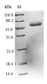 Human DCXR Protein (Recombinant GST, N-terminus)
