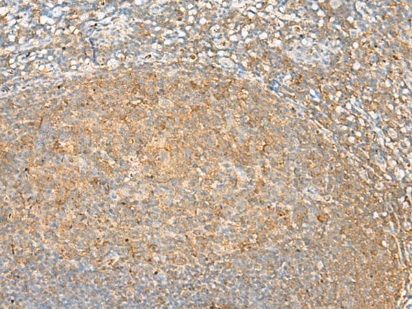 GRHPR / Glyoxylate Reductase Antibody