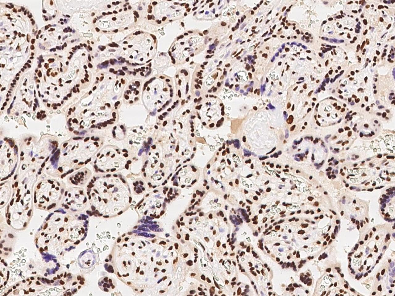 Polyclonal Rabbit anti-Human HNRPA1 / HnRNP A1 Antibody (IHC)