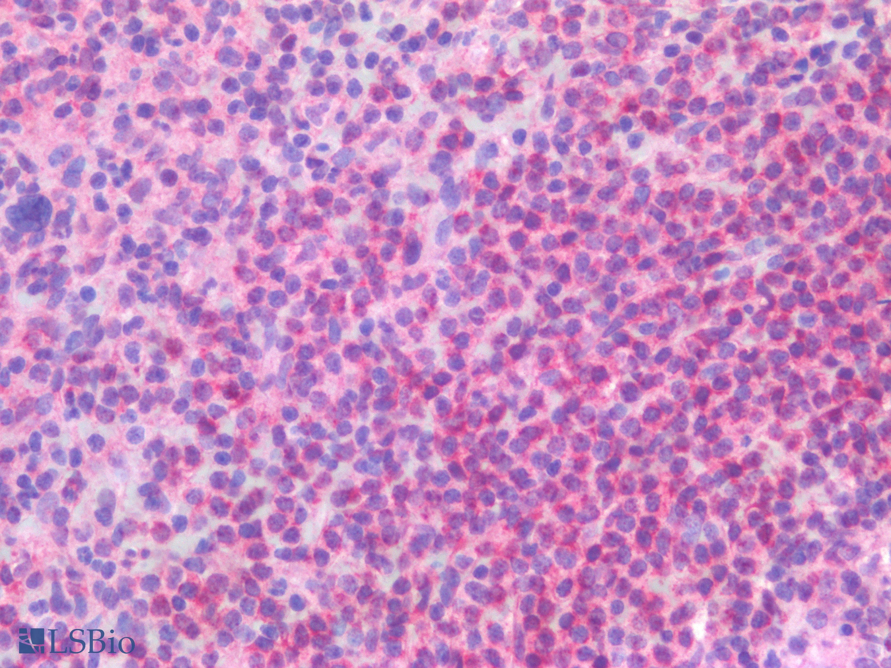 IHC-plus™ Polyclonal Rabbit anti-Human CD300A Antibody (IHC)