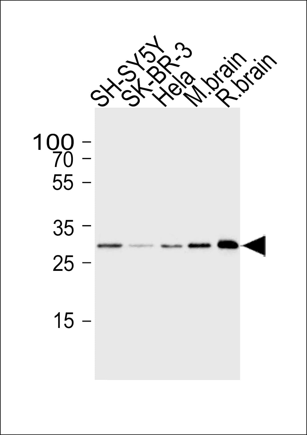 CDK5 Antibody (clone 1321CT281.130.129)