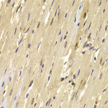 Polyclonal Rabbit anti-Human TOPBP1 Antibody (IHC, IF, WB)