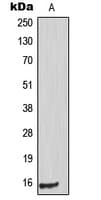 TP53I11 / PIG11 Antibody (Internal)