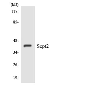 IHC-plus™ SEPT2 / Septin 2 Antibody (aa87-136)
