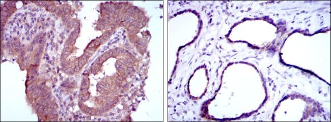 Monoclonal Mouse anti-Human MTHFR Antibody (clone 5D3, IHC, WB)