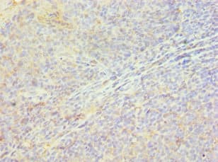 HSPB8 / H11 / HSP22 Antibody (aa1-196)