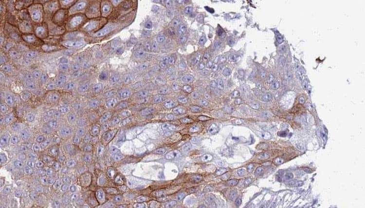 TRPM7 Antibody
