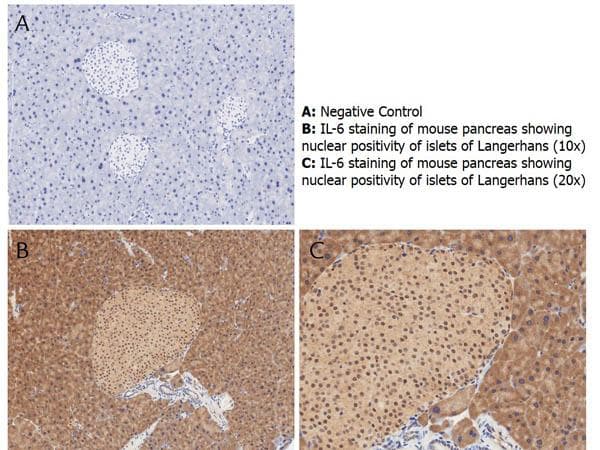 Polyclonal Rabbit anti-Mouse IL6 / Interleukin 6 Antibody (IHC, WB)