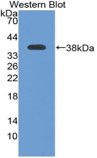 ATR Antibody (aa2353-2644, FITC)