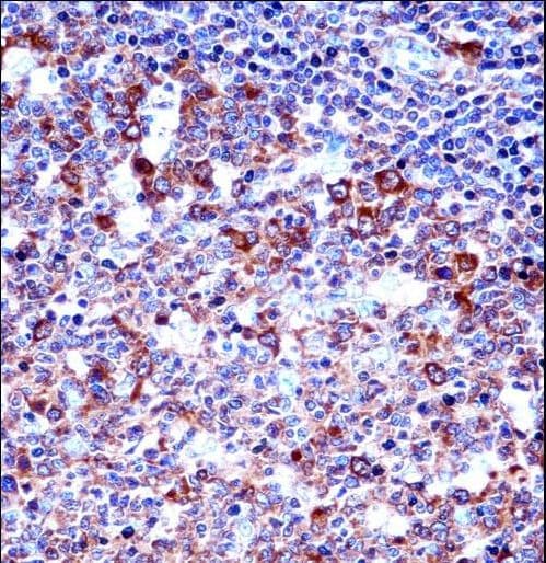 SPN / CD43 Antibody (aa230-257)