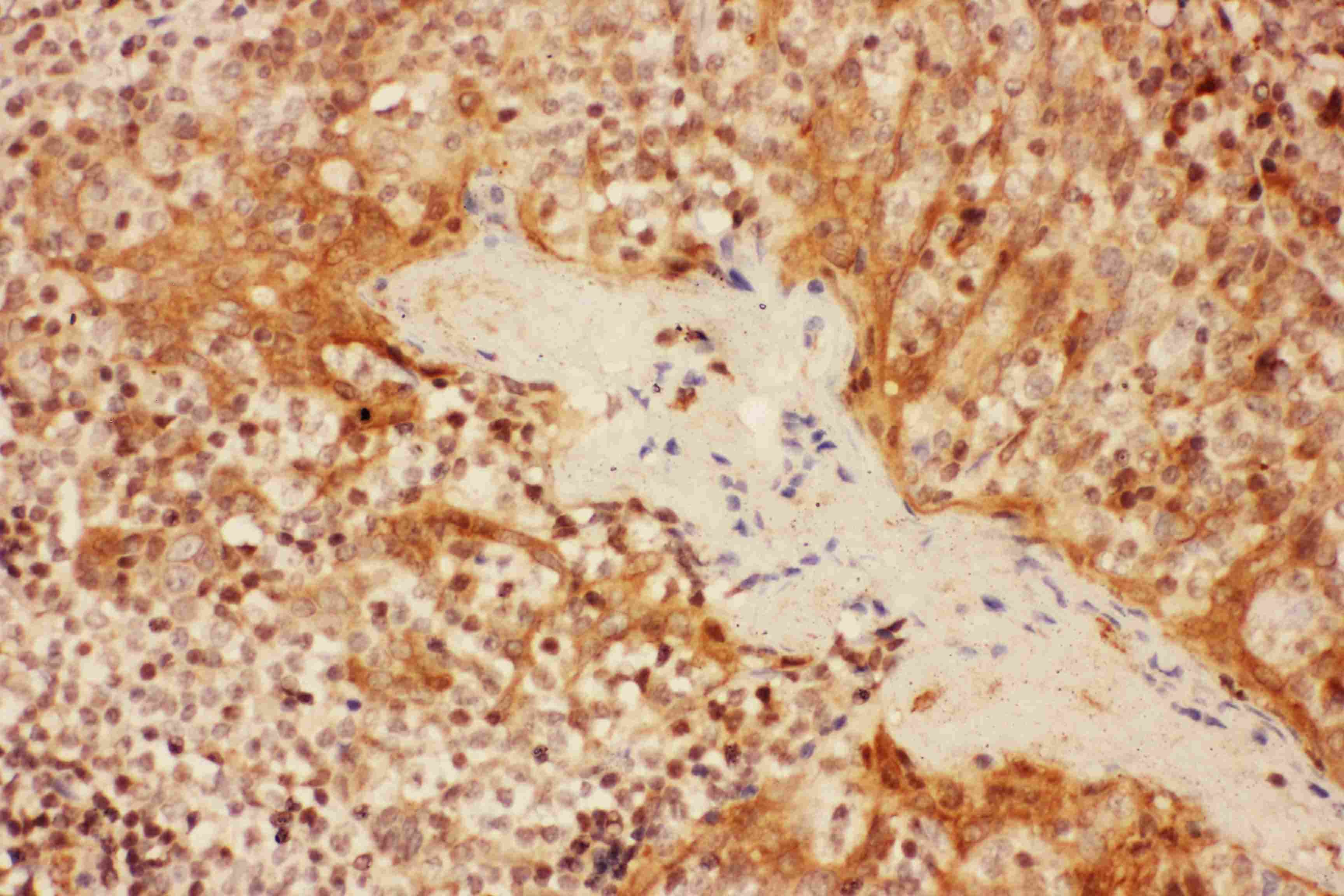 IL2RA / CD25 Antibody (aa39-57)