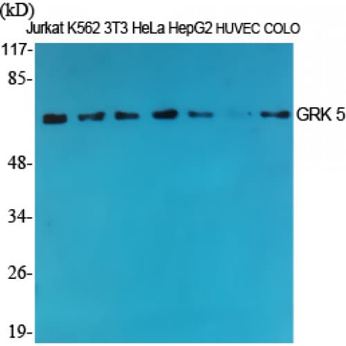 GRK5 Antibody (320-400 aa, Internal)
