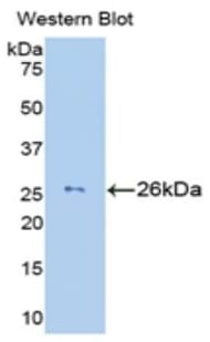 GZMM / Granzyme M Antibody (aa26-257)