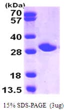 Human NNMT Protein (Recombinant His)