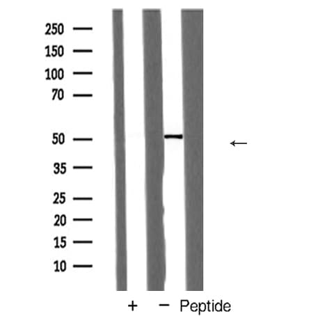 Polyclonal Rabbit anti-Human CD71 / Transferrin Receptor Antibody (IHC, IF, WB)
