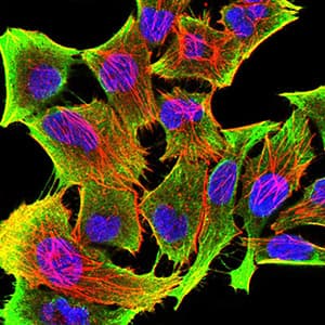 TH / Tyrosine Hydroxylase Antibody (clone 1B8D2)