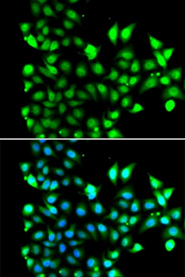 Polyclonal Rabbit anti-Human SNRPD2 Antibody (IHC, IF, WB)
