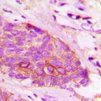Polyclonal Rabbit anti-Human SNCA / Alpha-Synuclein Antibody (C-Terminus, IHC, IF, WB)