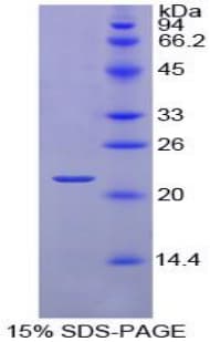 Chicken RBP4 Protein (Recombinant His)