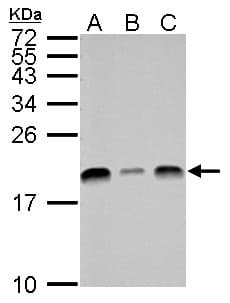 Polyclonal Rabbit anti-Human UBE2L3 / UBCH7 Antibody (aa92-154, IHC, WB)